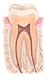 Endodontic Treatment